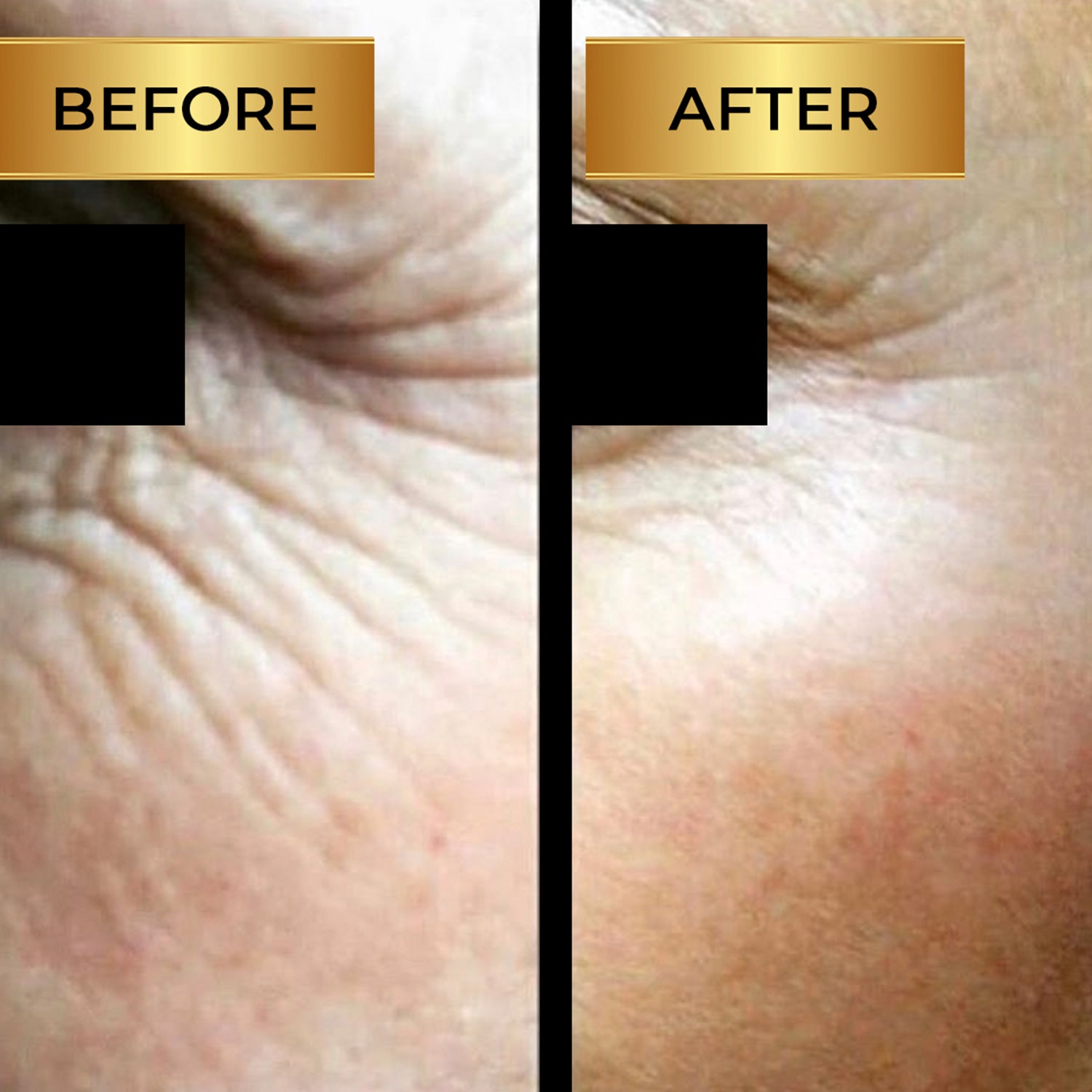 Instant Face Lift Gel – beauxi™